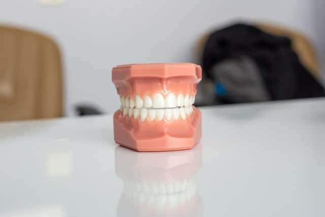Implanty ceramiczne: Połączenie estetyki i wytrzymałości Twojego uśmiechu